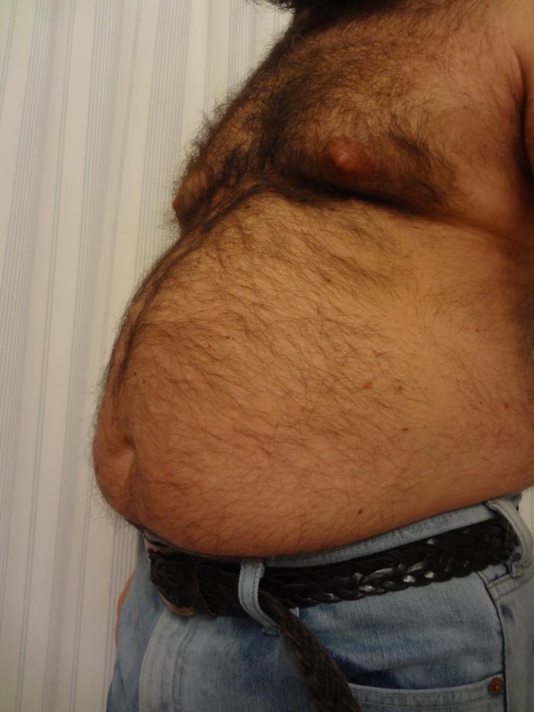 From otter to bear …someday I hope this will be my “before” pic.  - I hope
