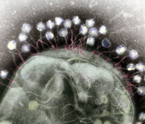 Tufts of bacteriophage (viruses that infect bacteria) cling to the large cell they’re infestin