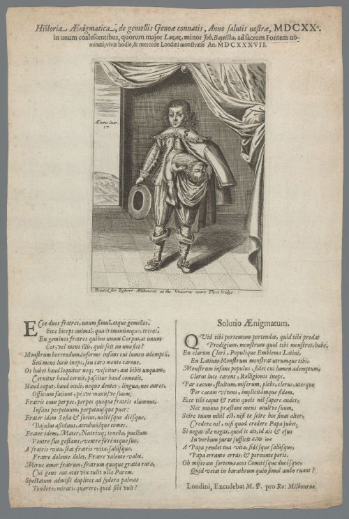 Conjoined twins from Genoa, Italy exhibited in London in 1637.Historia aenigmatica, de gemellis Geno