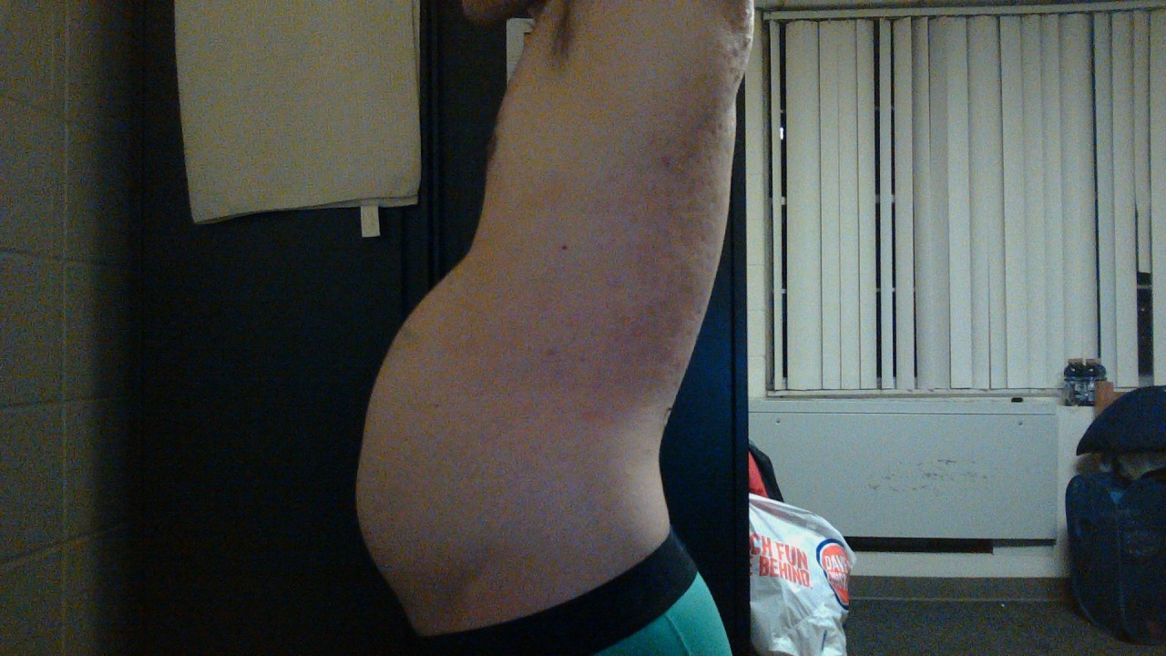 bigwolfcakebelly:  My first year of gaining. :) Here’s to hopefully doubling my