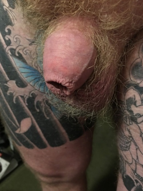 Nothing that a circumcision couldn’t fix