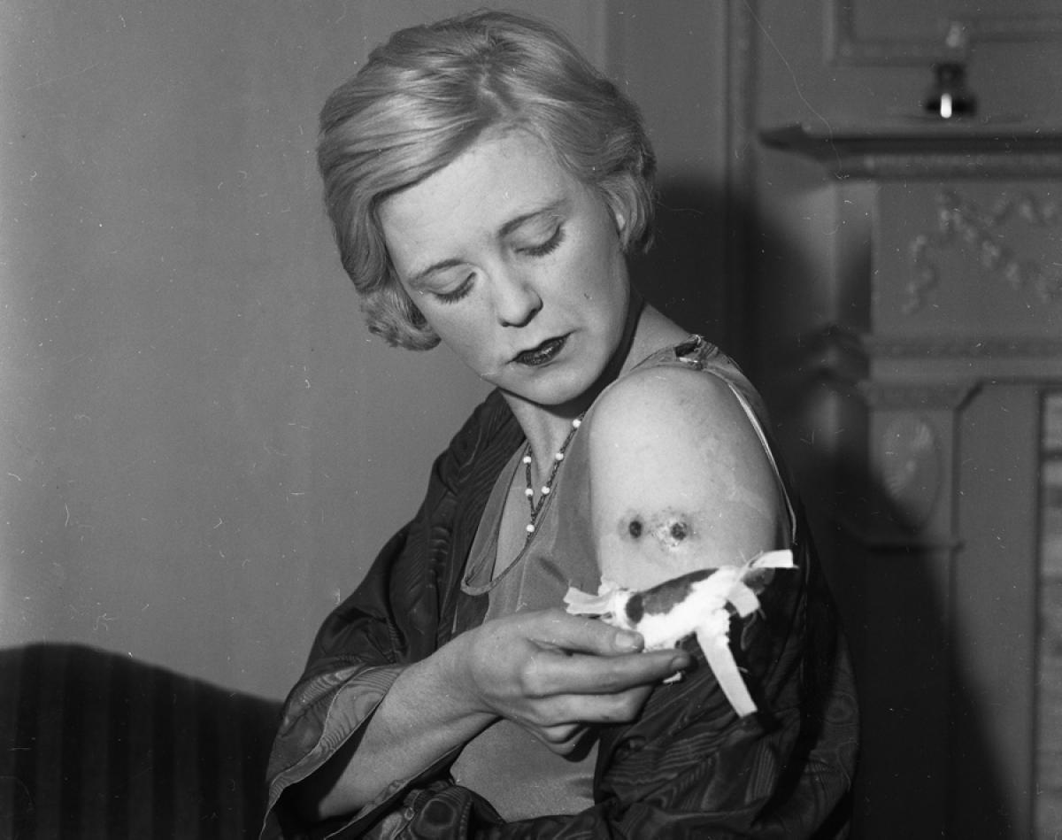 weirdvintage:  Actress Alice Granville shows off two bullet holes in her arm after