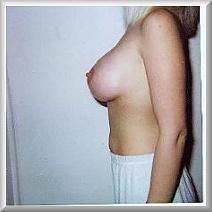 breastsandbraanalysis:  ..before and after adult photos