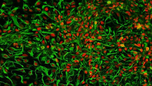 mothernaturenetwork:
“ Scientists make brain cells from pee
Unlike other stem cell technologies, the pee-based brain cells didn’t form tumors when implanted into rats
”
YUP!