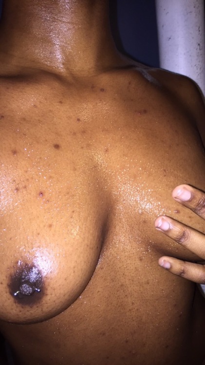 mplaa:  Oiled up at photoshoot.  My imperfections make me beautiful.