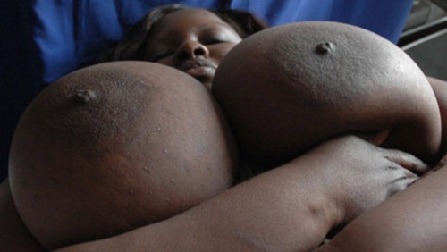 ( ⊙ Y ⊙ ) Tits