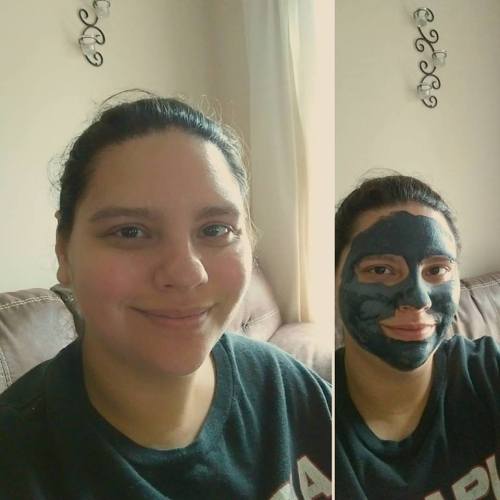 sarahmartinsperfectlyposhspa:   My face is literally so clean! I typically have lots of black heads 