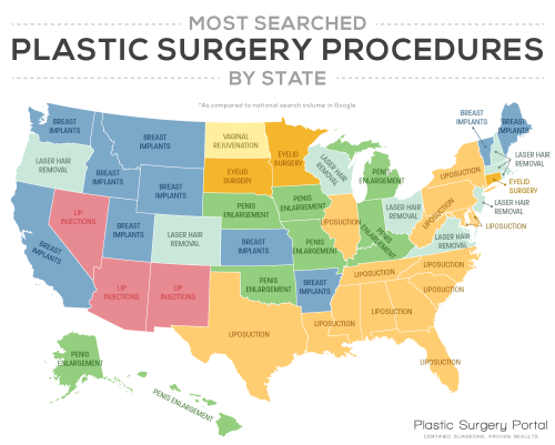 mapsontheweb:  Most searched plastic surgery procedures by US state, 2016. More popular searches maps >> 