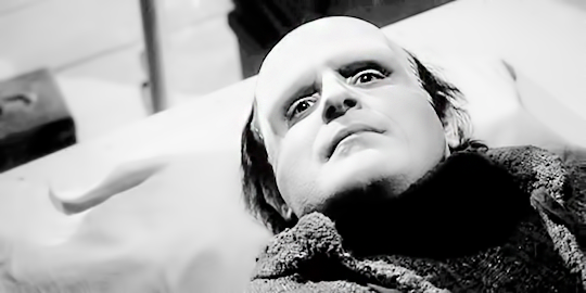 dessinnoir:  “Abby… Normal. I’m almost sure that was the name.”Young Frankenstein