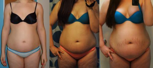 omgdotti:She wanted to be fat 165kbs to 269 lbs in 18 months !! She loved it ! X