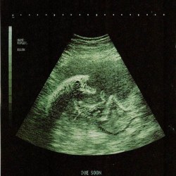 eightbitsuicide:  #alien #prenatal 