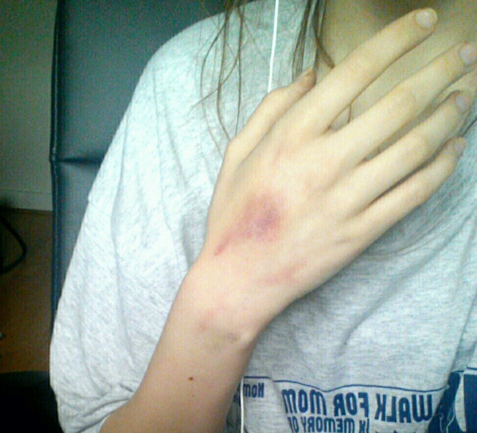 Awww Zoe I wanna give you hickeys on your hands