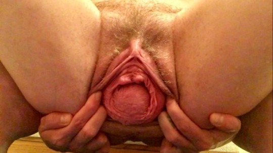 loosepussyland:  swollencock89:    @maxeengreen   PROLAPSED CUNT MEAT  …looks like