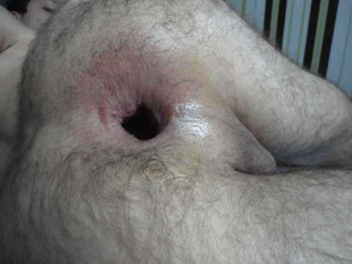 Superhitzkopf submitted: