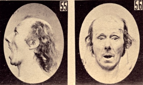 photos-de-france:  Mécanisme de la physiologie humaine ou analyse électro-physiologique de l’expression des passions, par le Docteur Duchenne (de Boulogne), 1876. C’est en 1862 que G.-B. Duchenne de Boulogne, médecin français (1806-1875), publie