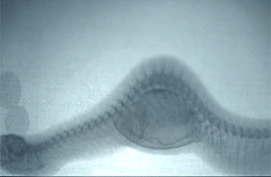 brainsx:  X-ray of a snake swallowing an egg 