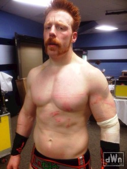 all-day-i-dream-about-seth:  sparkenrose:  builddudebuild:  Sheamus  My poor baby) All bruised and battered….. But I love you)  Seeing Sheamus bruised is really hot to me. That beautiful pale skin of his shows bruises so perfectly!