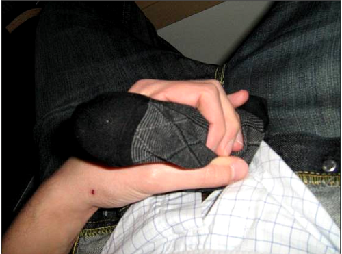 blacksocks2000:  One man one sock! 