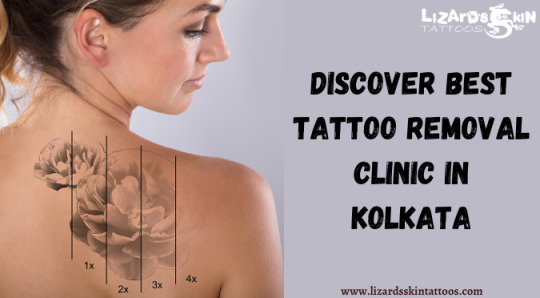 Tattoo Removal in Kolkata | Explore Tumblr Posts and Blogs | Tumpik