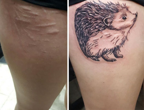 greeneyes-anddimples:pr1nceshawn:Tattoos That Turned People’s Scars Into Works Of Art.I’