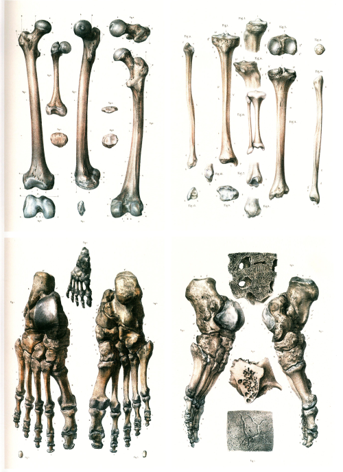 brettkingery:Selections from the “Atlas of Human Anatomy and Surgery” by Jean-Marie Le Minor and Hen