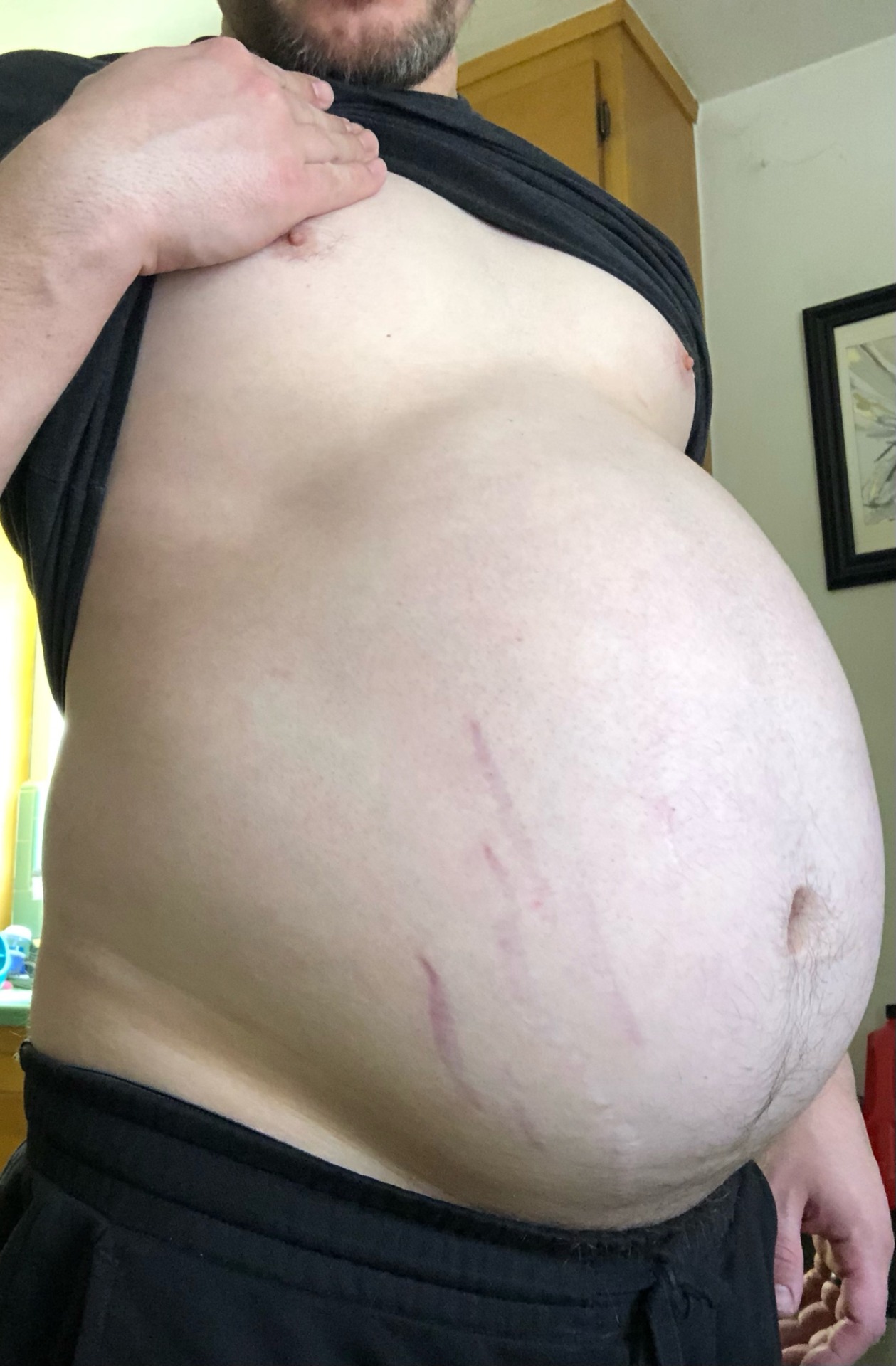 flyflyfatty-deactivated20230319:For some reason I was told to consider losing weight.