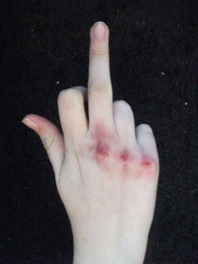 kisskissmollys-lips:Bruised hands collection