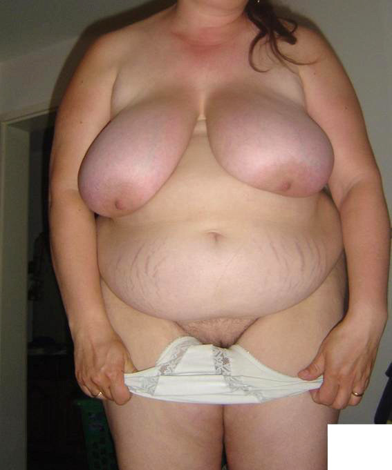 bbwbellyhang:  stretch marks