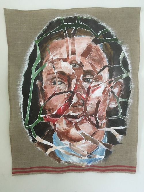 819221, acrylic on linen, December 2018Patient of Harold Gillies, a plastic surgeon who worked on so