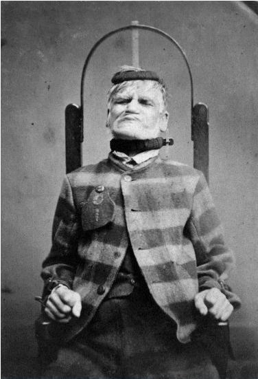 Patient in restraint chair at the West Riding Lunatic Asylum, Wakefield, Yorkshire,