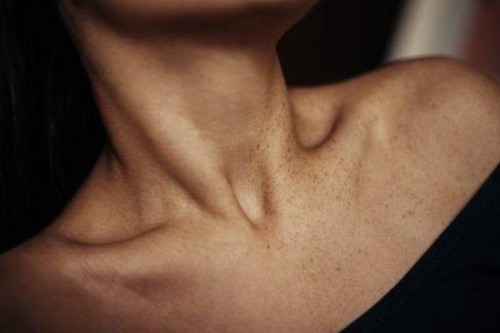 "you Can See Her Bones, Isn't That Concerning?""i Think That's Beautiful"