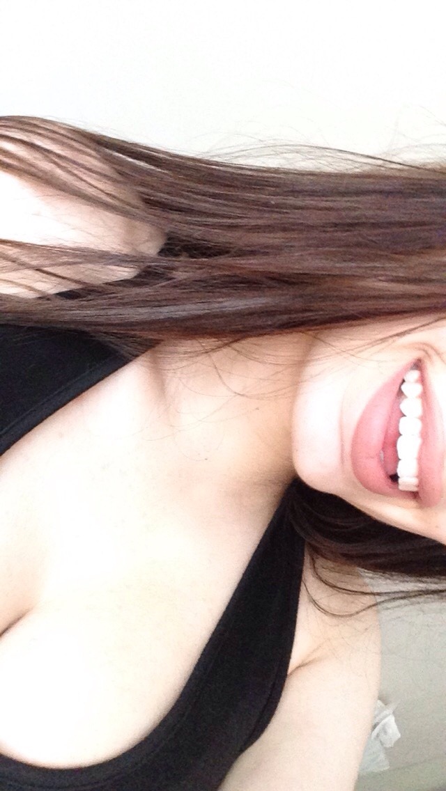losershawty:  braces off