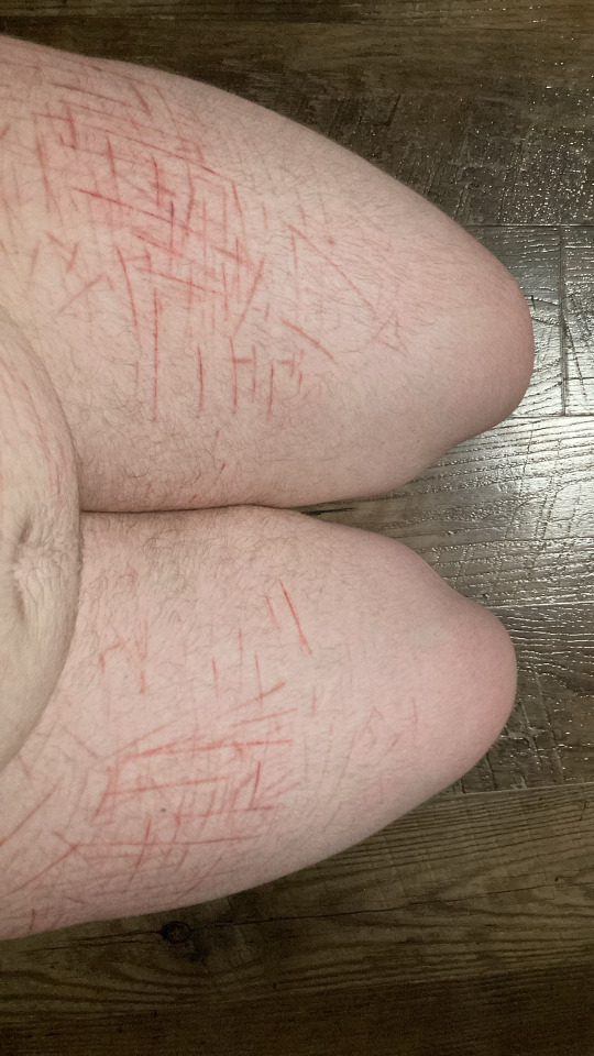 TW Self Harm!