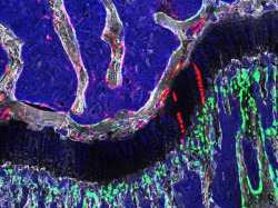 bpod-mrc:  25 January 2015 Skeleton Crew Inside this femur [thigh bone] lies a type of cell that once helped to build the skeleton in the womb, and could be reawakened to help ageing joints. Osteochondroreticular (OCR) stem cells, labelled with a red