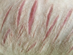 knifeslices2:  scar tissue