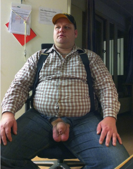 Thickbear In Texas