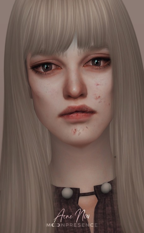 moonpres-sims:ACNE N037 variants | 3 transparency options | all ages | all genders | base game compa