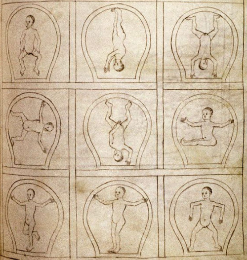 stillhereunfortunately:medieval:Diagrams of embryos in various positions.14th c. (via) get sillay