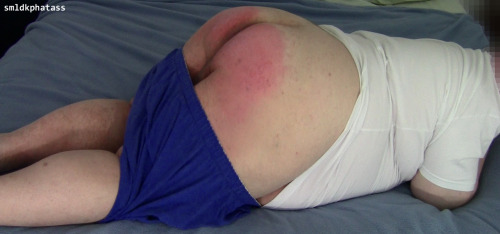 smldkphatass:Bad boys get spanked! My red ass after spanking with paddle. »» smldkphatass »»  Home | Archive | About | Follow