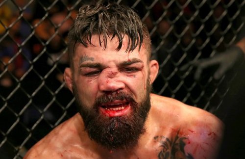 beautifulviolence:UFC Fight Night Uruguay Mike Perry face after fight with Vicente Luque