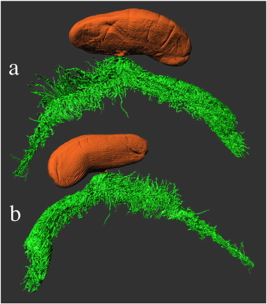 Micro CT data of the rhizocephalan internal structure, a tangle of roots in a horseshoe shape, with an egg sac hanging off.