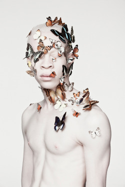 wetheurban:  ALBUS: Smashing the Albino Taboo