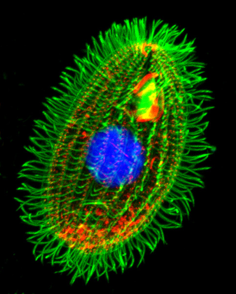 Tetrahymena from outside and inside :)