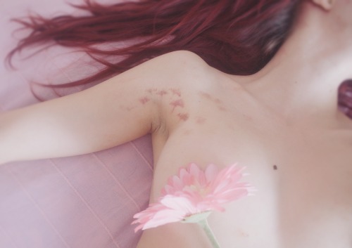 rouge-chevre:  Bruises http://rouge-chevre.tumblr.com/ 