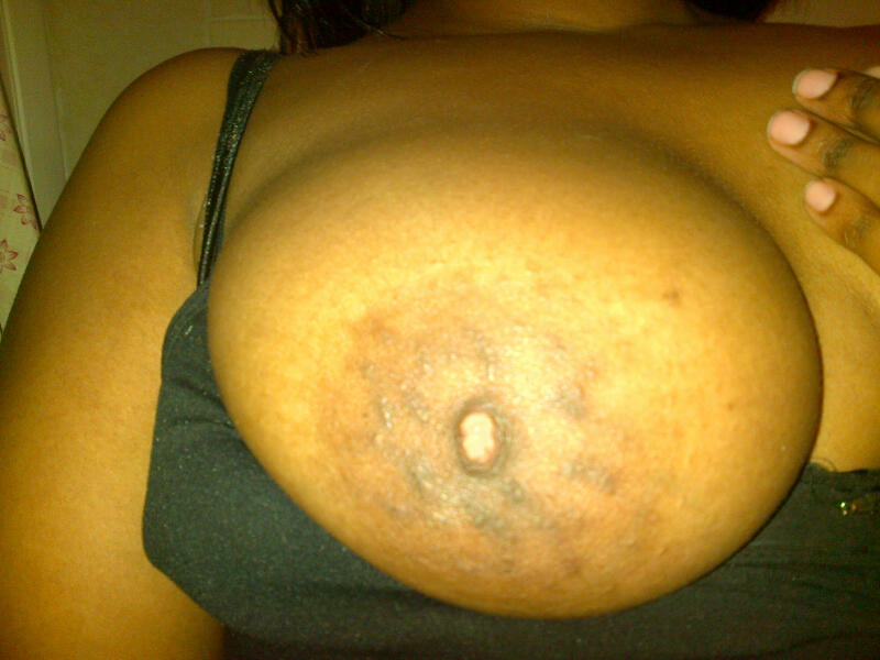 bbwsonly15:  BBW BREAST