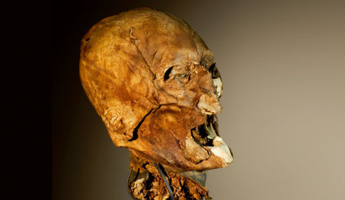 Mummified head of King Henry IV of France (?)