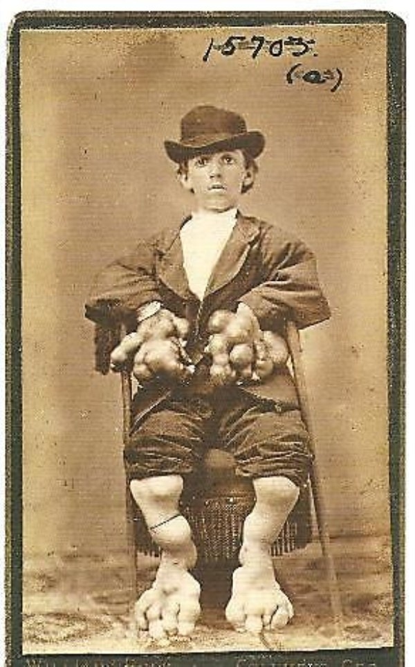 carnytrash:  resonanceinthehalls:  Vintage Photography of Circus ‘freaks’ and