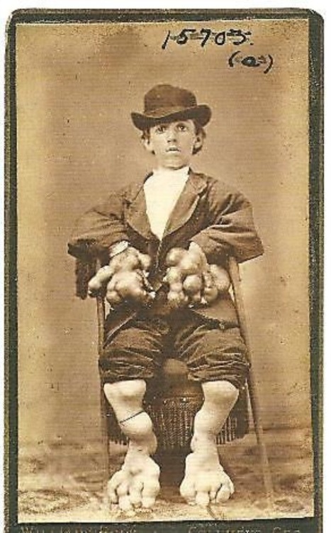carnytrash:  resonanceinthehalls:  Vintage Photography of Circus ‘freaks’ and attractions.   The seventh photo is actually a still from the film Freaks, and despite the insistence of people using that terminology, it’s quite derogatory.  Though