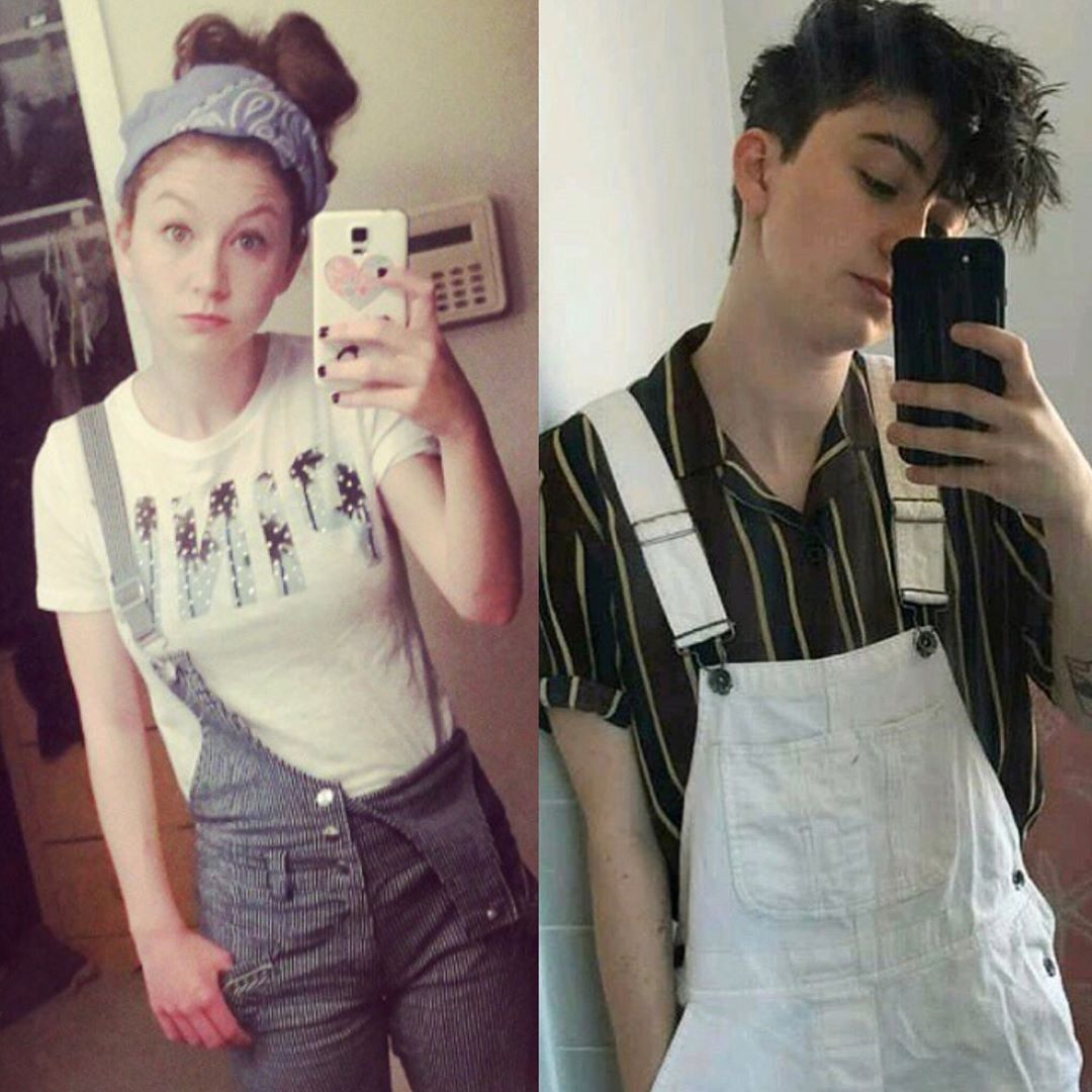niall69sara-blog:  Miles / before and after  - still hot tho