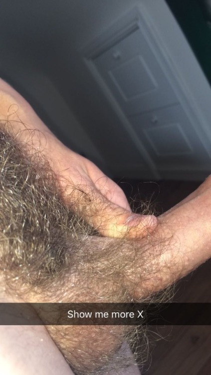 Smegma Sex Foreskin